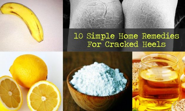 10 Simple Home Remedies for Cracked Heels