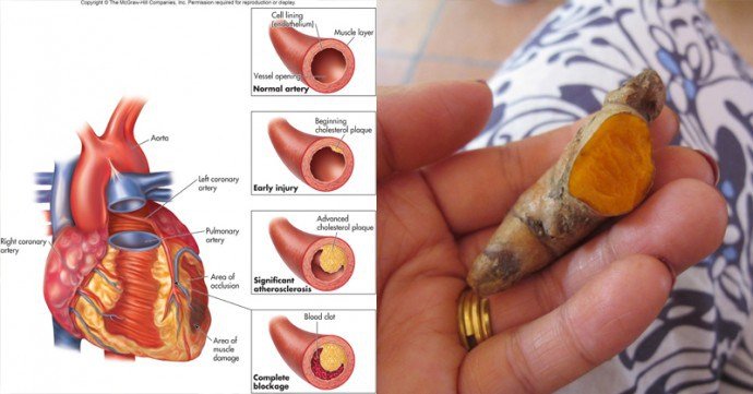 turmeric-and-exercise